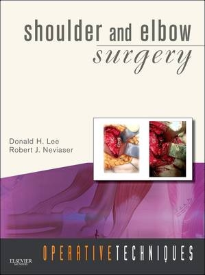 Operative Techniques: Shoulder and Elbow Surgery - Donald Lee, Robert J. Neviaser