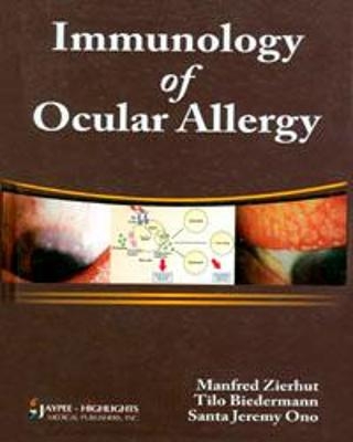 Immunology of Ocular Allergy - Manfred Zierhut, Tilo Biedermann, Santa Jeremy Ono