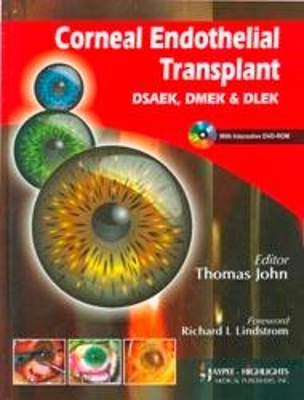 Corneal Endothelial Transplant DSEAK, DMEK and DLEK - Thomas John