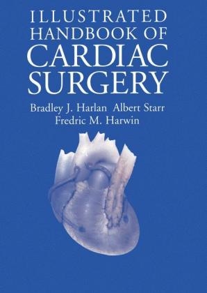 Illustrated Handbook of Cardiac Surgery -  Bradley J. Harlan,  Fredric M. Harwin,  Albert Starr