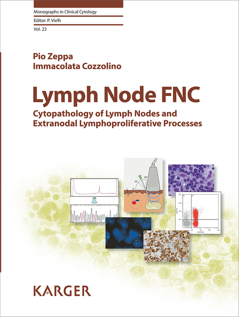 Lymph Node FNC - P. Zeppa, I. Cozzolino