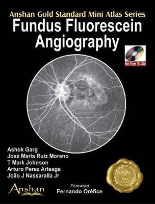 Mini Atlas of Fundus Fluorescein Angiography -  Venktatesh