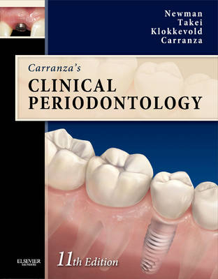 Carranza's Clinical Periodontology Expert Consult - Michael G. Newman, Henry Takei, Perry R. Klokkevold, Fermin A. Carranza