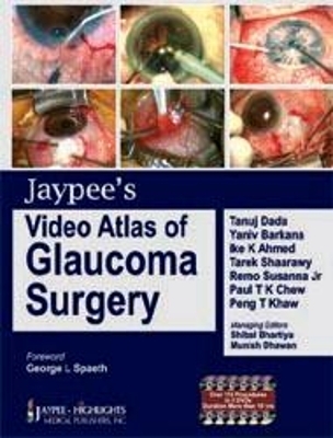 Jaypee's Video Atlas of Glaucoma Surgery - Tanuj Dada