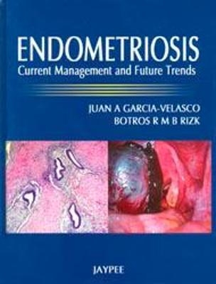 Endometriosis - Juan A Garcia-Velasco, Botros RMB Rizk