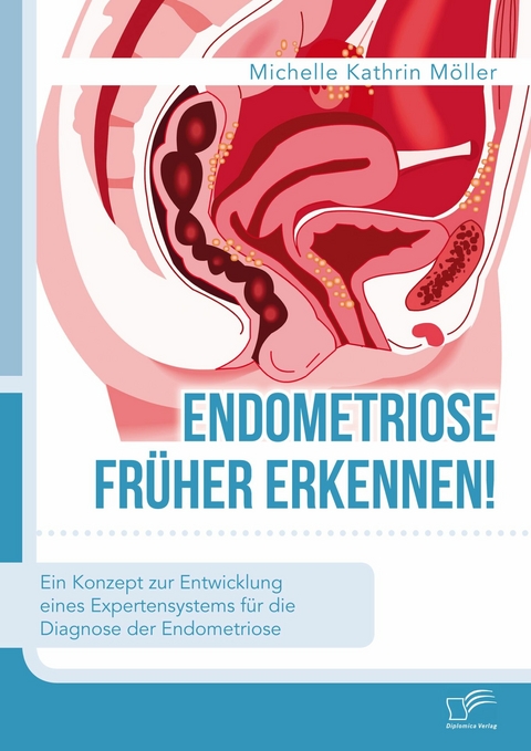 Endometriose früher erkennen! Ein Konzept zur Entwicklung eines Expertensystems für die Diagnose der Endometriose -  Michelle Kathrin Möller