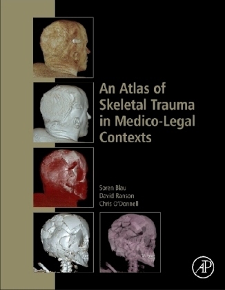 Atlas of Skeletal Trauma in Medico-Legal Contexts -  Soren Blau,  Chris O'Donnell,  David Ranson