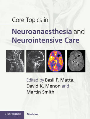 Core Topics in Neuroanaesthesia and Neurointensive Care - 