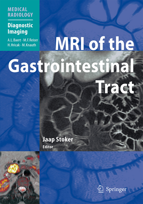 MRI of the Gastrointestinal Tract - 
