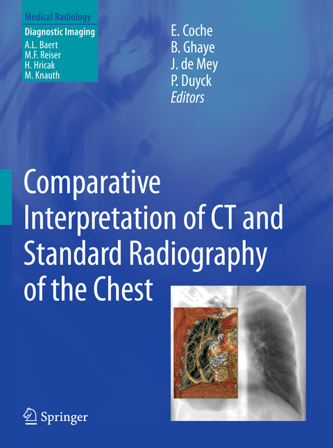 Comparative Interpretation of CT and Standard Radiography of the Chest - 