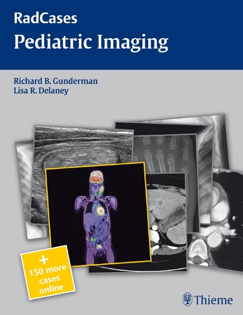 Radcases Pediatric Imaging - Richard B. Gunderman, Lisa R. Delaney
