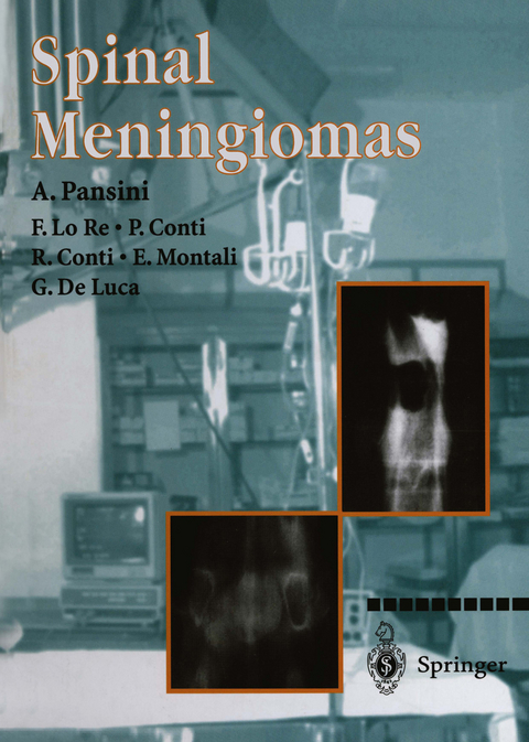 Spinal Meningiomas - A. Pansini, F. Lo Re, P. Conti, E. Montali, G- De Luca