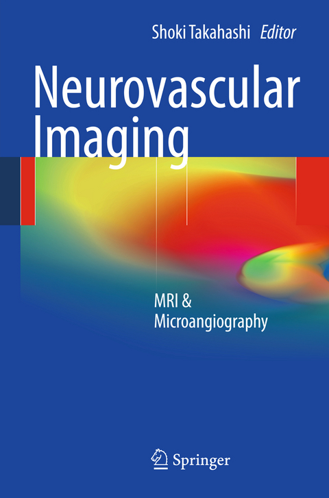 Neurovascular Imaging - 