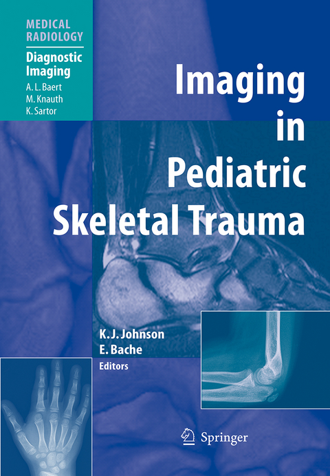Imaging in Pediatric Skeletal Trauma - 