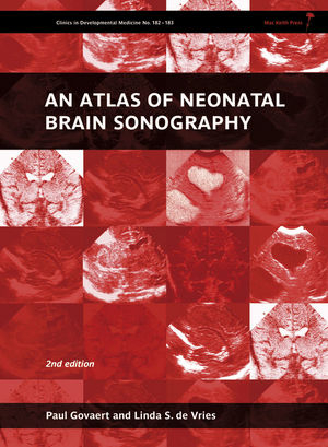 An Atlas of Neonatal Brain Sonography - Paul Govaert, Linda S. de Vries