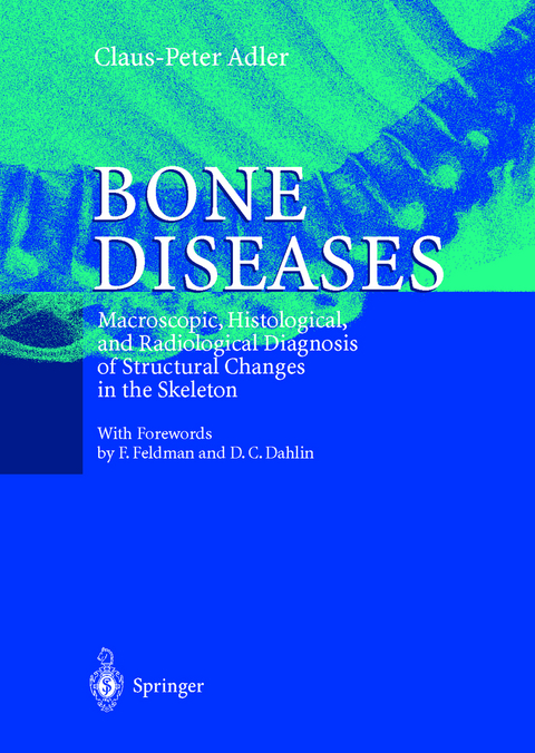 Bone Diseases - Claus-Peter Adler