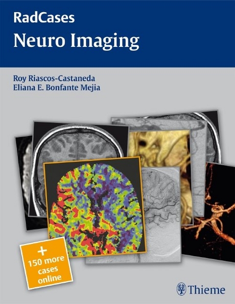 Radcases Neuro Imaging - 