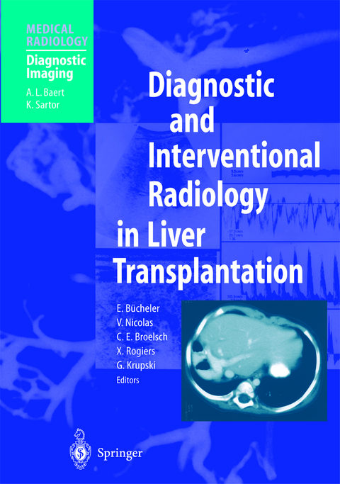 Diagnostic and Interventional Radiology in Liver Transplantation - 