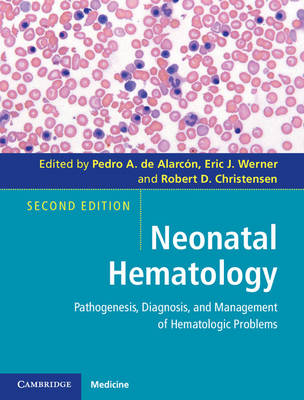 Neonatal Hematology - 
