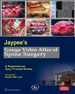 Jaypee's Ganga Video Atlas of Spine Surgery - S Rajasekaran, Ajoy Prasad Shetty