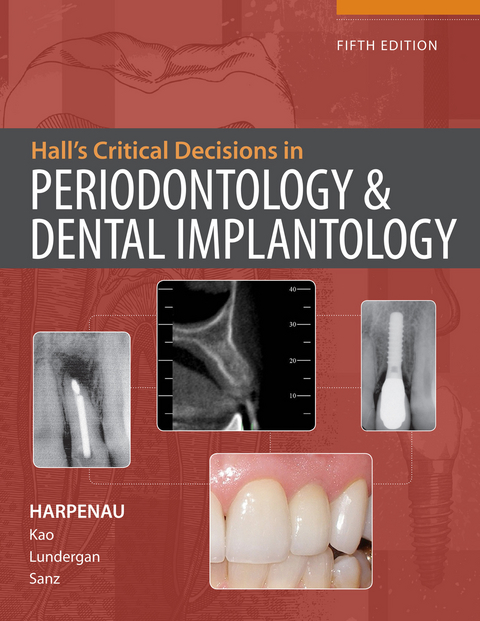 Hall's Critical Decisions in Periodontology & Dental Implantology, 5e - Lisa Harpenau