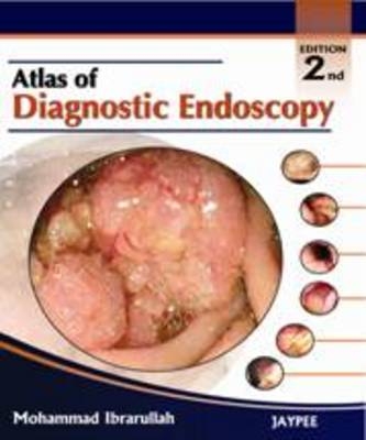 Atlas of Diagnostic Endoscopy, Second Edition - Mohammad Ibrarullah