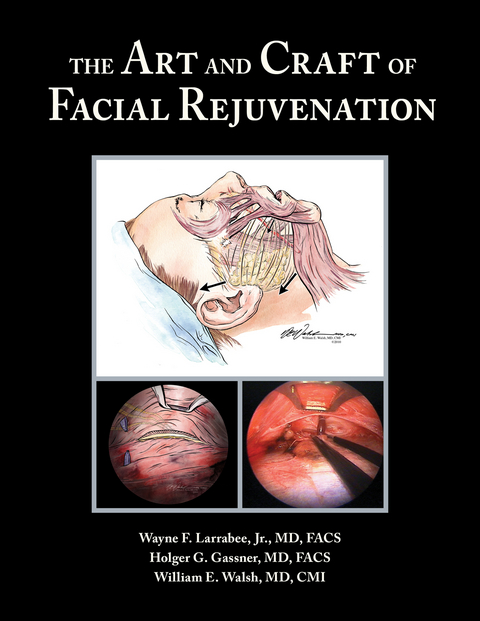 Art and Craft of Facial Rejuvenation -  Holger Gassner,  Wayne Larrabee,  William Walsh