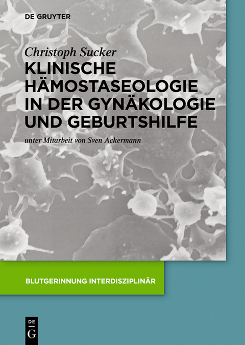 Klinische Hämostaseologie in der Gynäkologie und Geburtshilfe -  Christoph Sucker