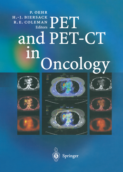 PET and PET-CT in Oncology - 