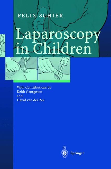 Laparoscopy in Children - Felix Schier