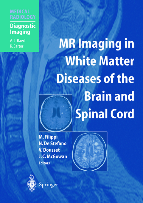 MR Imaging in White Matter Diseases of the Brain and Spinal Cord - 