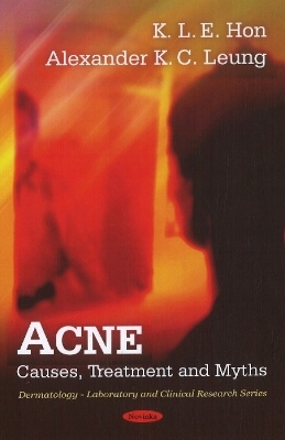 Acne - Alexander K C Leung, K I E Hon