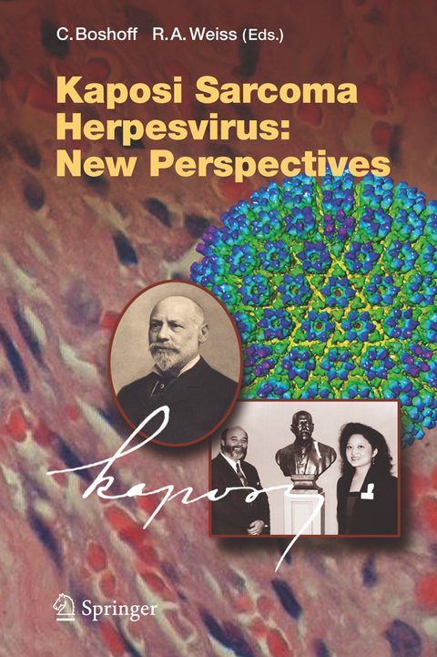 Kaposi Sarcoma Herpesvirus: New Perspectives - 