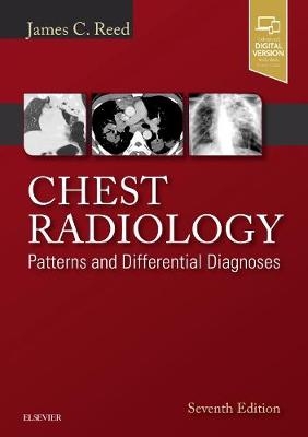 Chest Radiology: Patterns and Differential Diagnoses E-Book -  James C. Reed