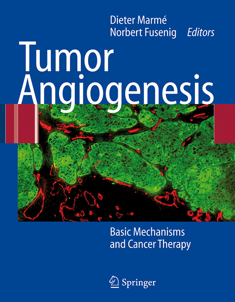 Tumor Angiogenesis - 