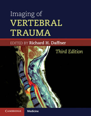 Imaging of Vertebral Trauma - Richard H. Daffner