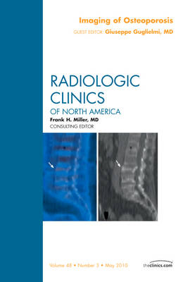 Imaging of Osteoporosis, An Issue of Radiologic Clinics of North America - Giuseppe Guglielmi