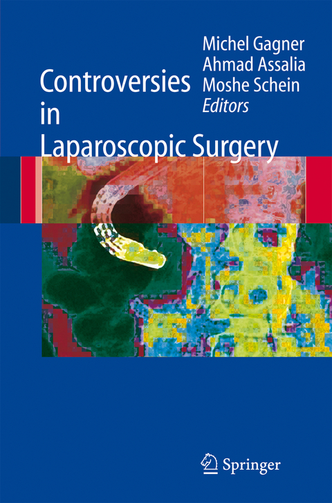 Controversies in Laparoscopic Surgery - 