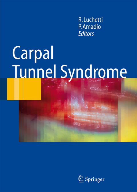 Carpal Tunnel Syndrome - 