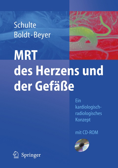 MRT des Herzens und der Gefäße - B. Schulte, A. Boldt, D. Beyer