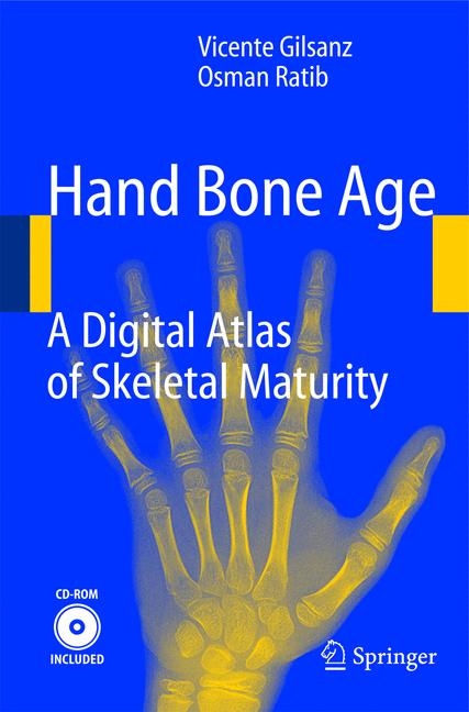 Hand Bone Age - Vicente Gilsanz, Osman Ratib