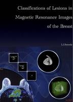 Classifications of Lesions in Magnetic Resonance Images of the Breast - Luke Ienari Sonoda