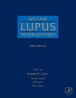 Systemic Lupus Erythematosus - 