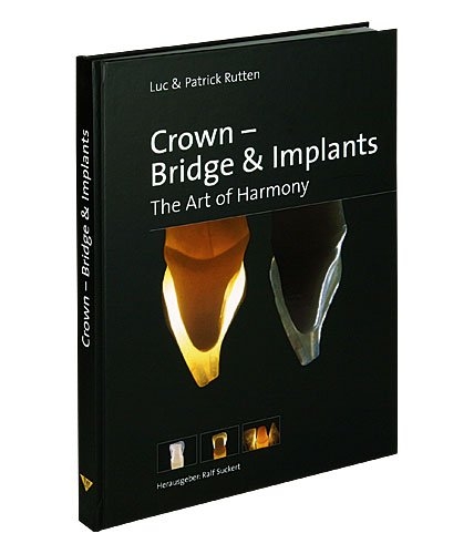 Crown - Bridge & Implants - Luc Rutten, Patrick Rutten