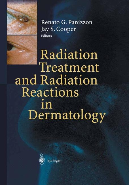 Radiation Treatment and Radiation Reactions in Dermatology - 