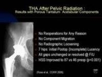 Adult Reconstruction Hip - 