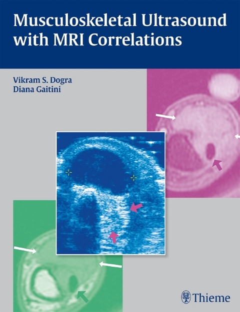 Musculoskeletal Ultrasound with MRI Correlations - 