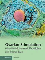 Ovarian Stimulation - 