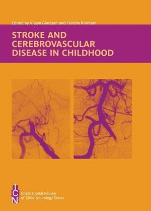 Stroke and Cerebrovascular Disease in Childhood - 