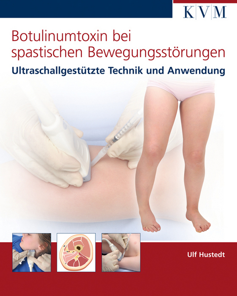 Botulinumtoxin bei spastischen Bewegungsstörungen - Ulf Hustedt